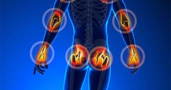 Arthritis Profile